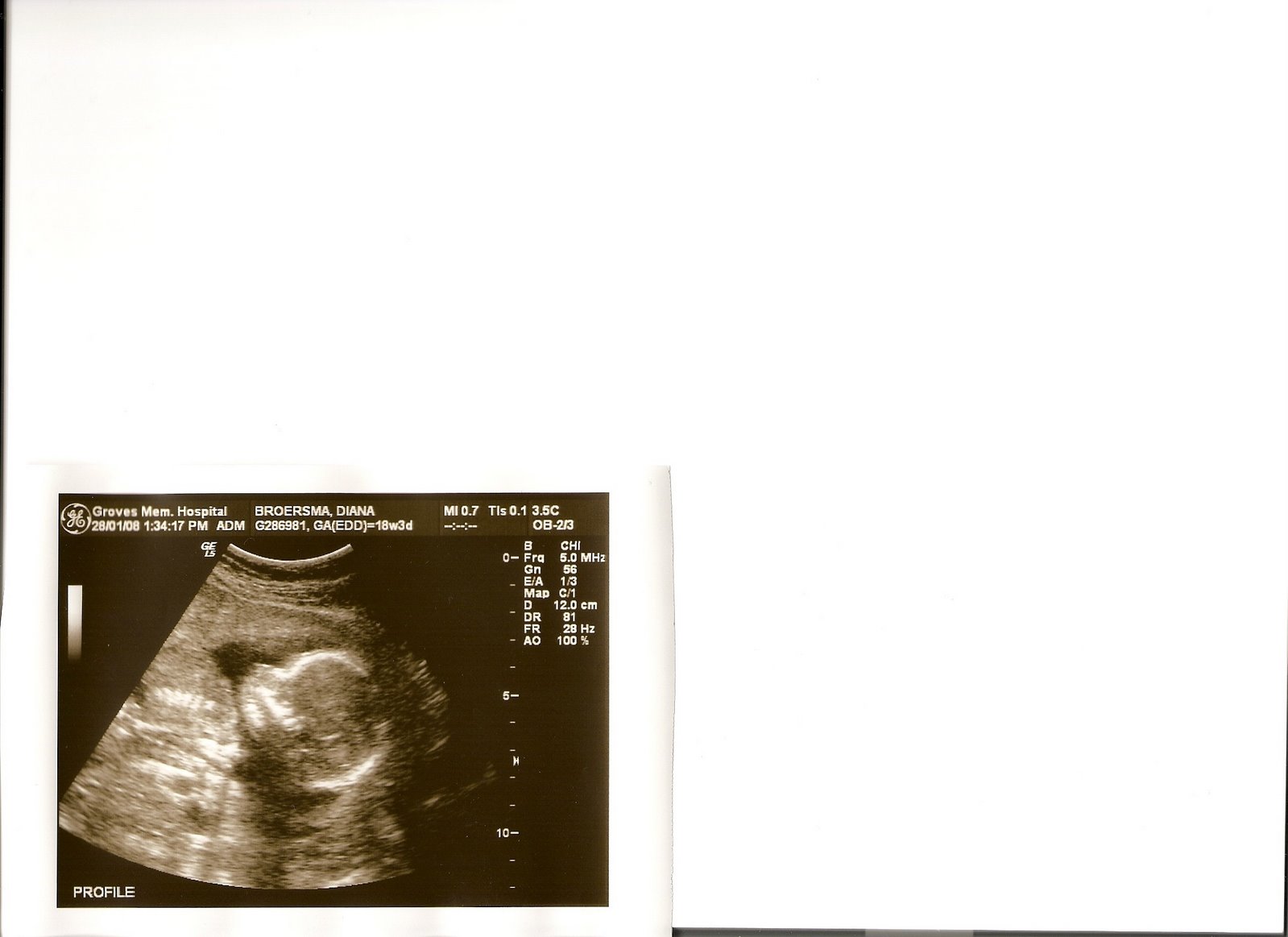 [ultrasound2.jpg]