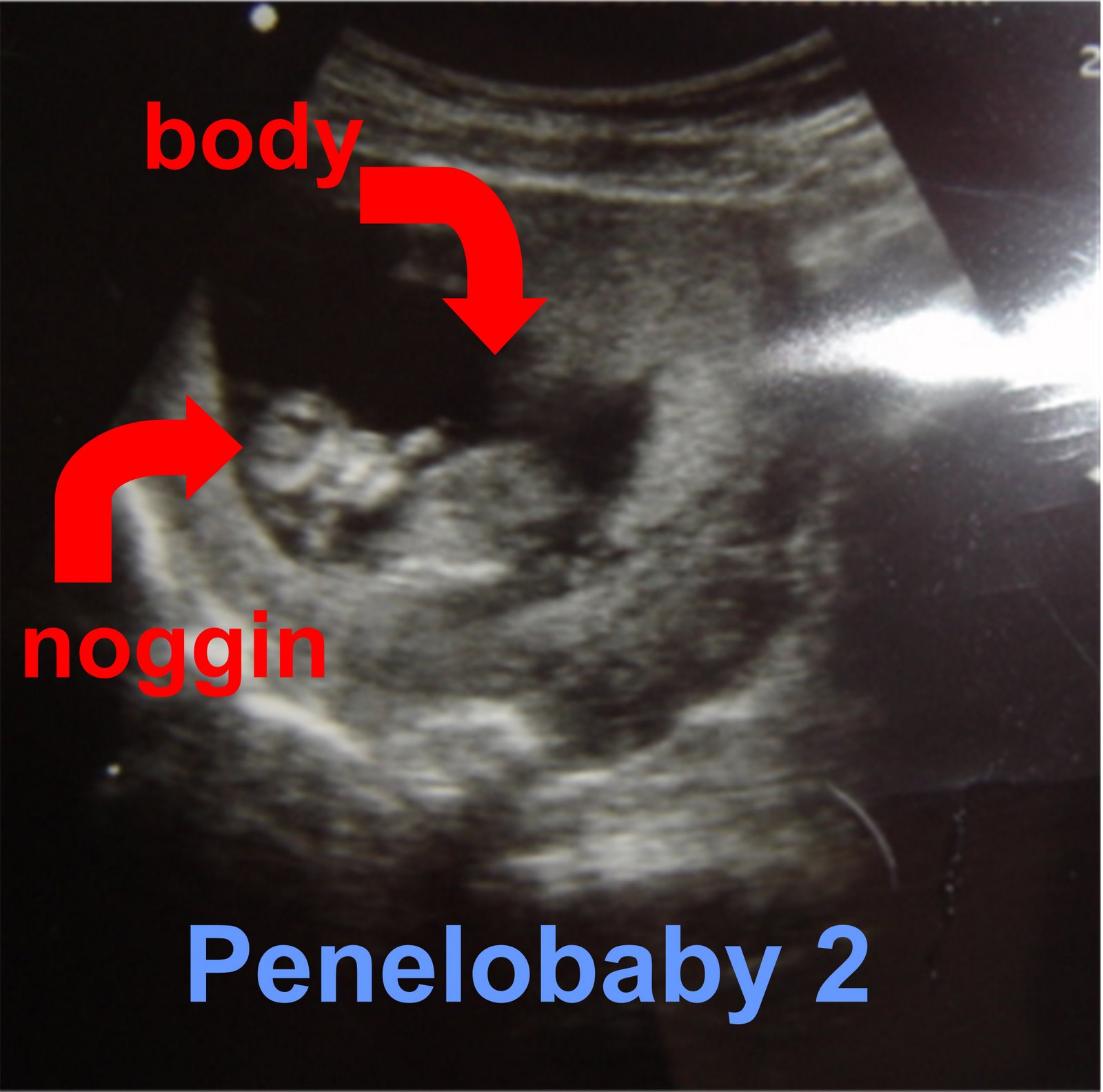 [Penelobaby2.jpg]