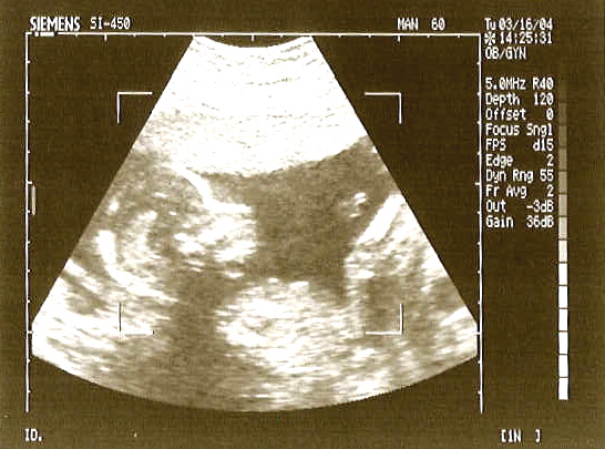 [rachels+ultrasound.jpg]