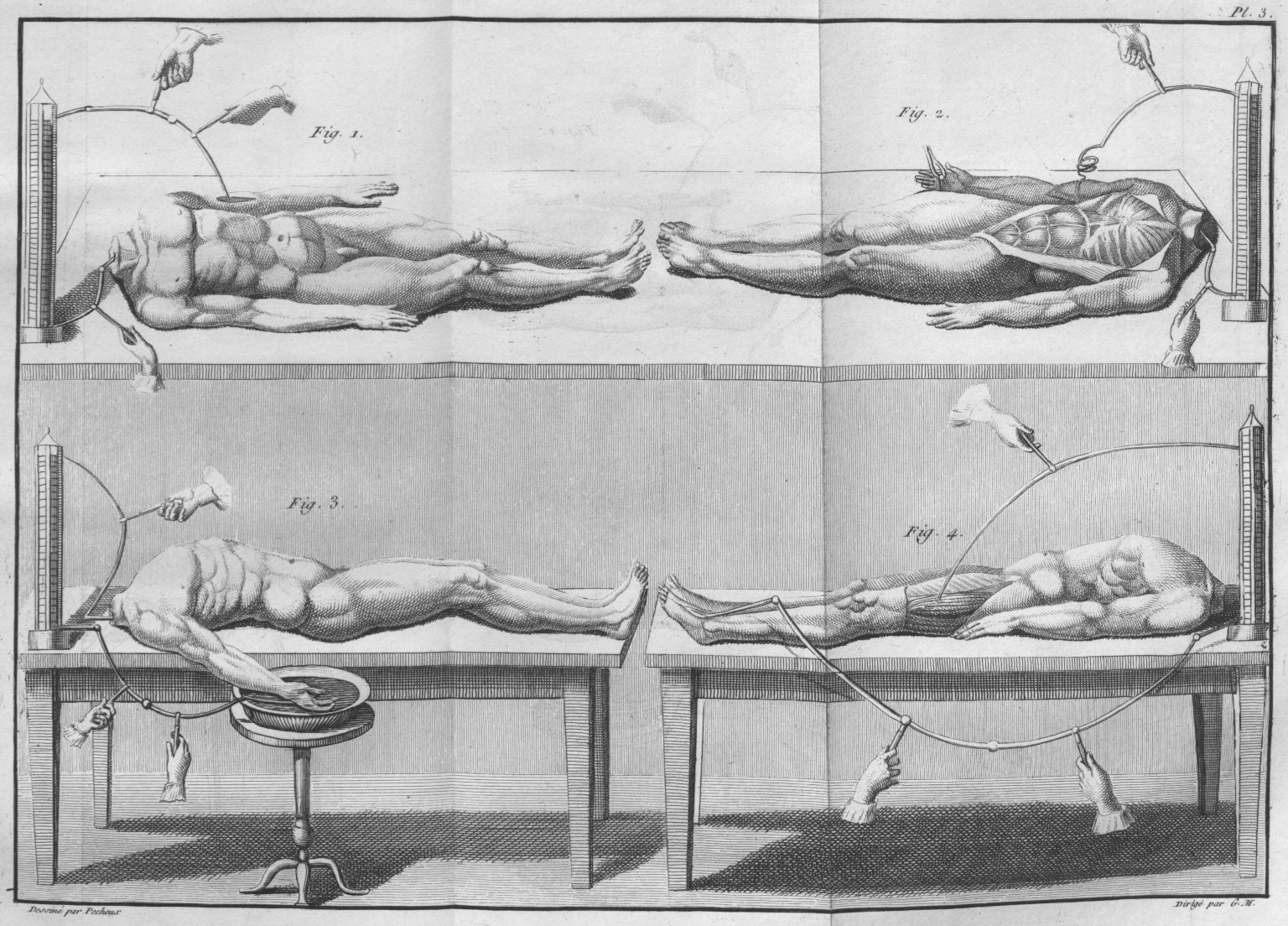 [Experiments+with+headless+cadavers+-+Essai+théorique+et+expérimental+sur+le+galvanisme+1804.jpg]