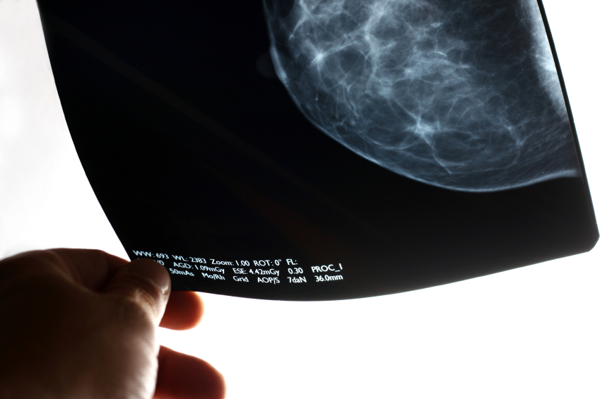 [mammogram.jpg]