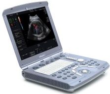 [4d+Ultrasound+GE+Voluson+i.jpg]