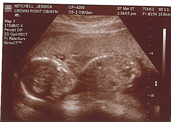 [2baby+ultrasound+20+weeks.jpg]