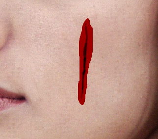 [bleeding+scar.jpg]