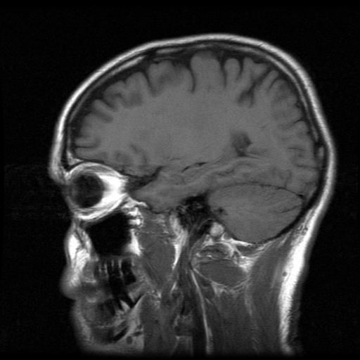 [1-19-2007+brain+MRI.jpg]