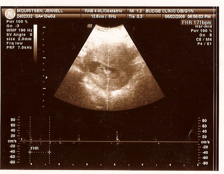[ultrasound.png]