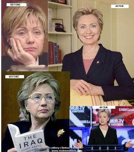 [Hilary-clinton-plastic-surgery-before-after-pictures2.jpg]