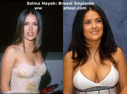 [Salma-hayek-breast-implants-2.jpg]