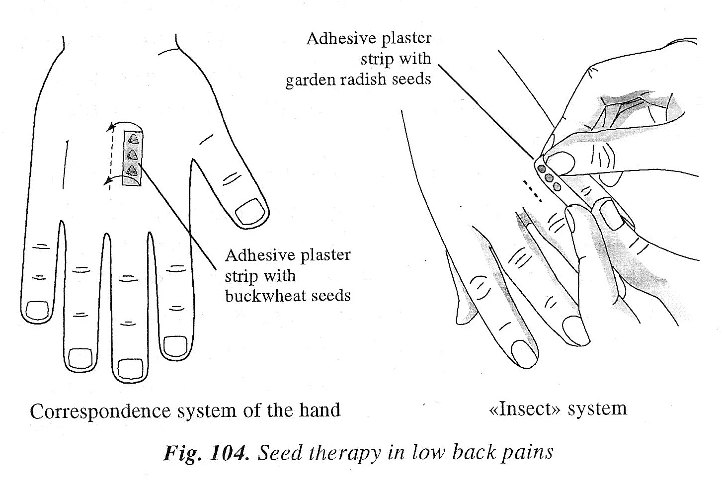 [Seed+Therapy+-+Low+back+Pain+104.jpg]
