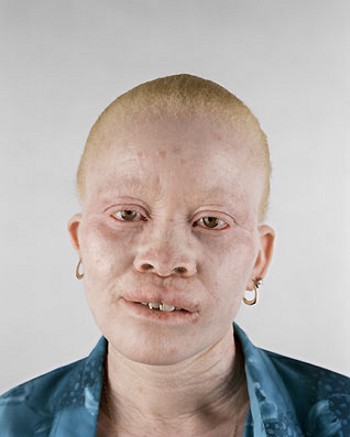 [albino-africans05.jpg]