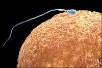 Creado esperma humano a partir de células embrionarias femeninas